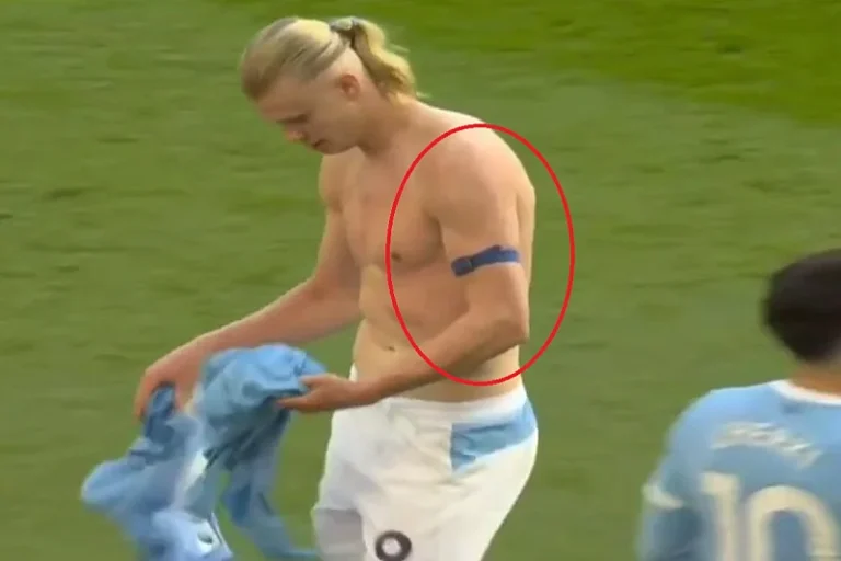 Халанд на раката носи уред кој му помага да биде „фудбалски ѕвер“